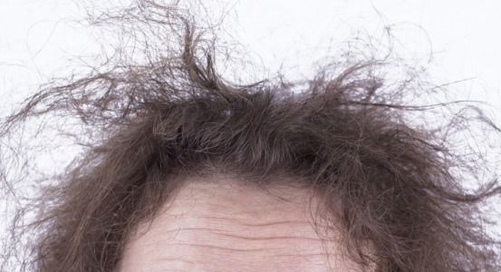 Πως να αντιμετωπίσεις το φριζάρισμα από την υγρασία με φυσικό τρόπο