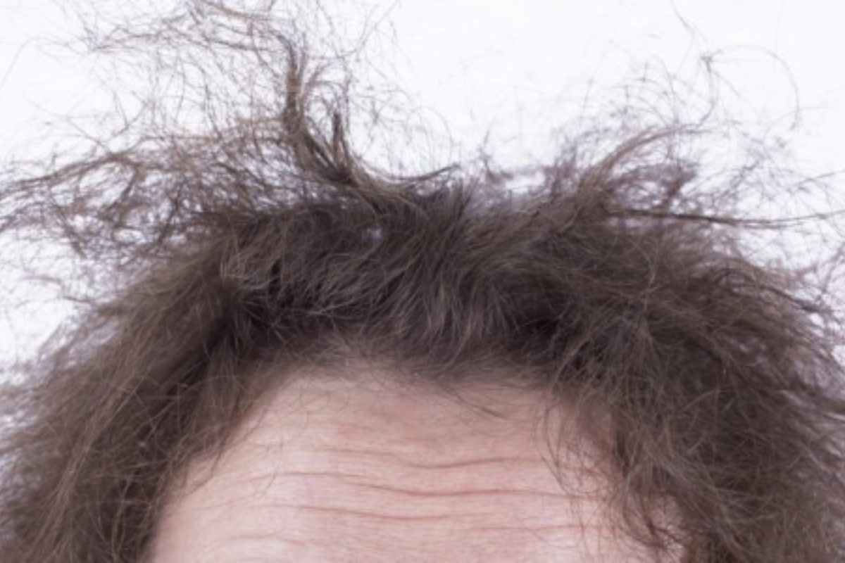 Πως να αντιμετωπίσεις το φριζάρισμα από την υγρασία με φυσικό τρόπο