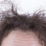 Πως να αντιμετωπίσεις το φριζάρισμα από την υγρασία με φυσικό τρόπο