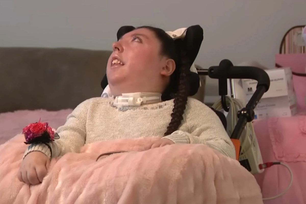 Γυναίκα που γεννήθηκε χωρίς εγκέφαλο έγινε 20 ετών ενώ οι γιατροί πίστευαν ότι δεν θα ζήσει πάνω από 4 χρόνια