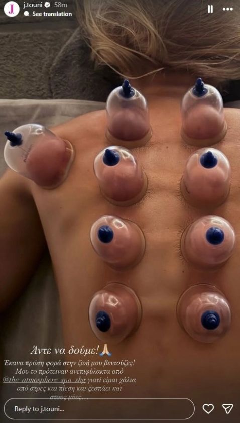 Ιωάννα Τούνη-θεραπεία-με-βεντούζες- Ιωάννα Τούνη-θεραπεία-με-βεντούζες-