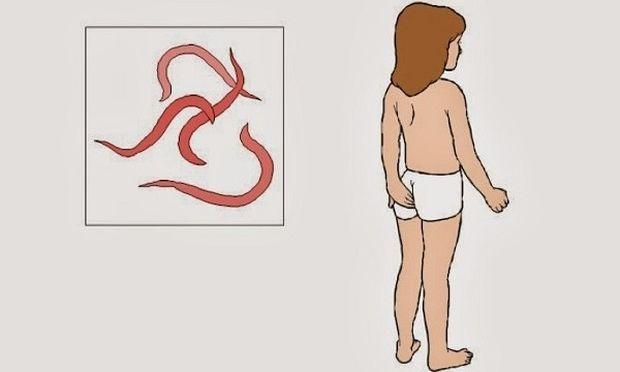 κνησμός-στο-σημείο-του-πρωκτού-