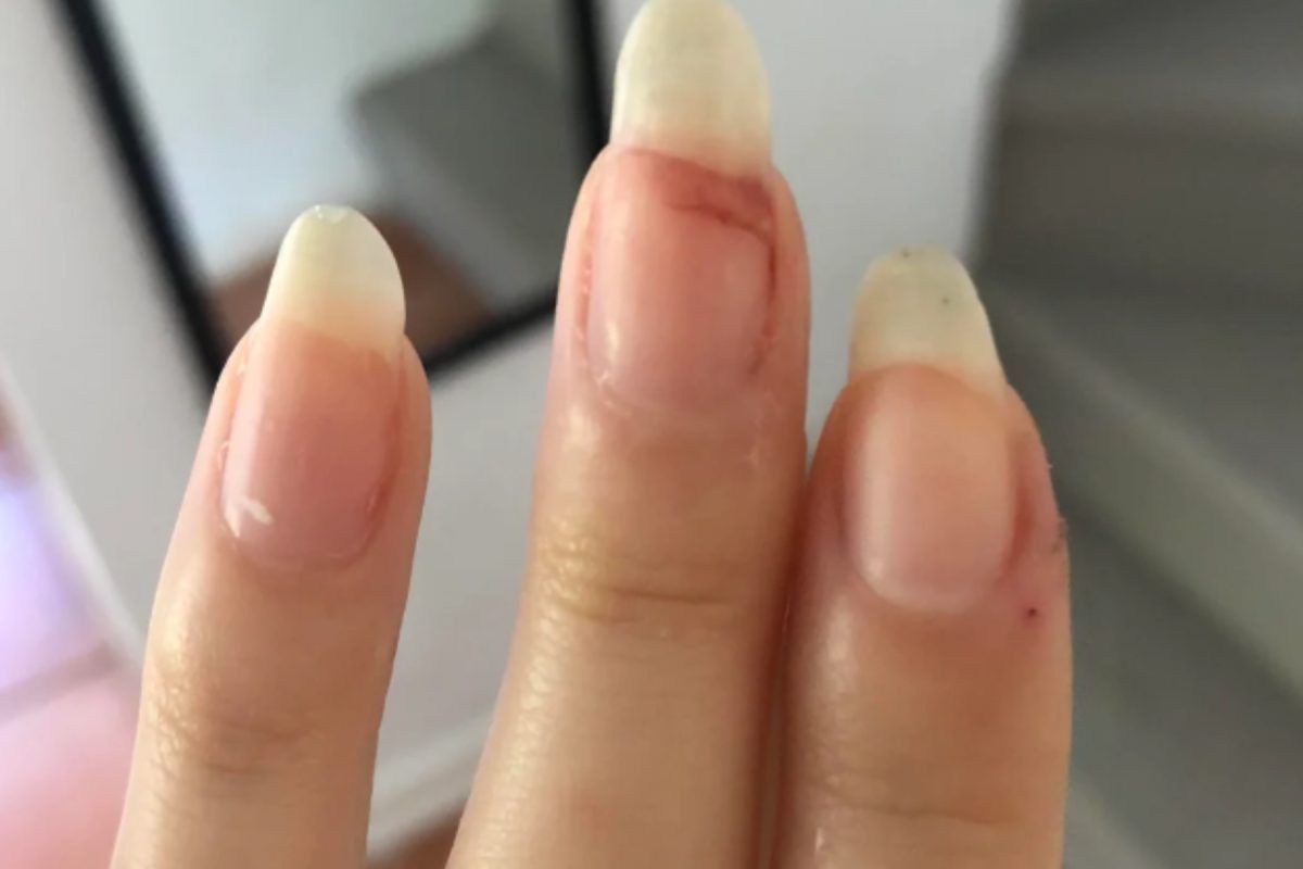 σπασμένα-μακριά νύχια-με-μελανιά-