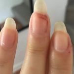 σπασμένα-μακριά νύχια-με-μελανιά-