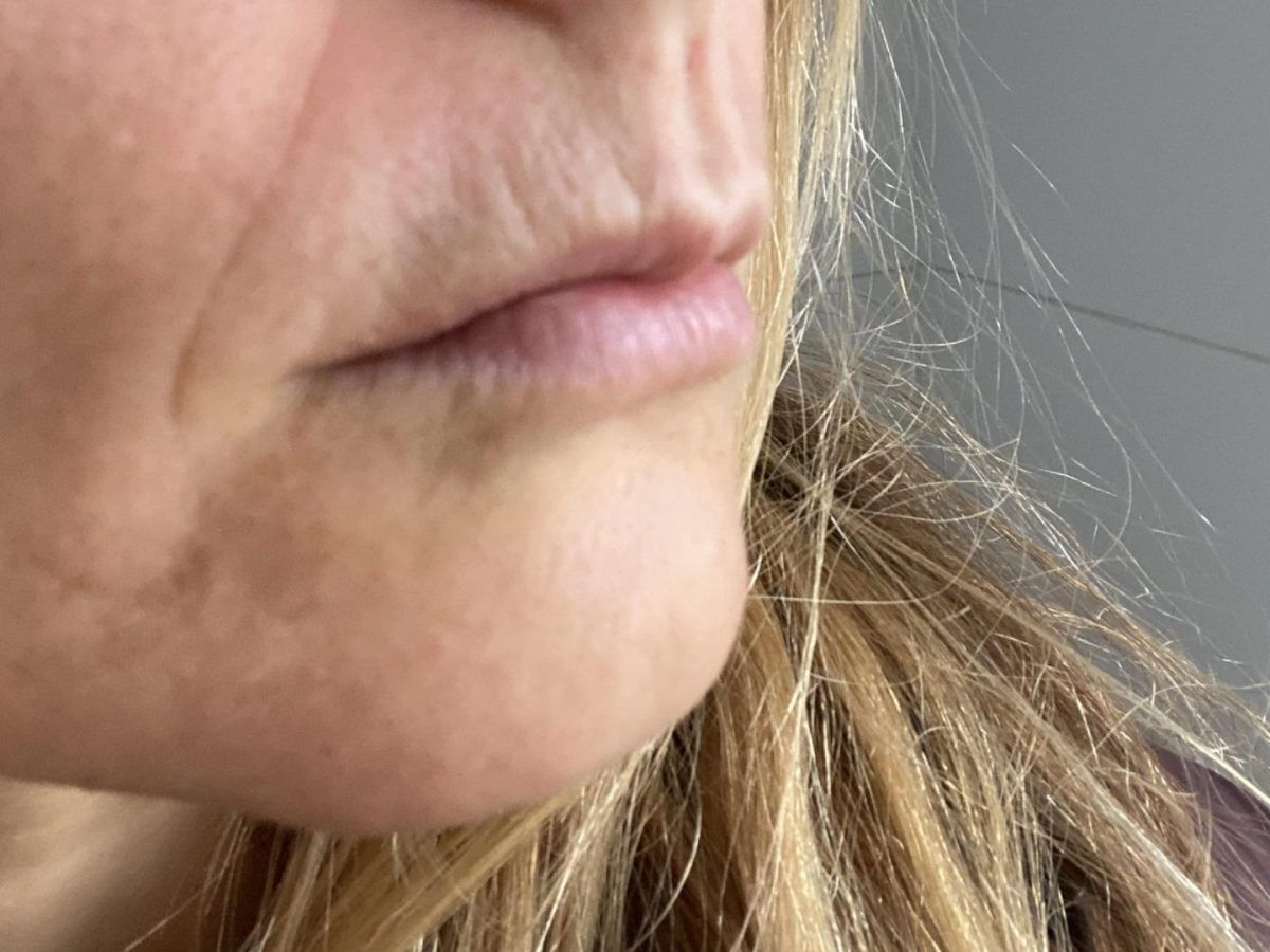 Το απόλυτο hack με το concealer για να σβήσεις μέσα σε 2 λεπτά τις λεπτές γραμμές και ρυτίδες γύρω από τα χείλη σου