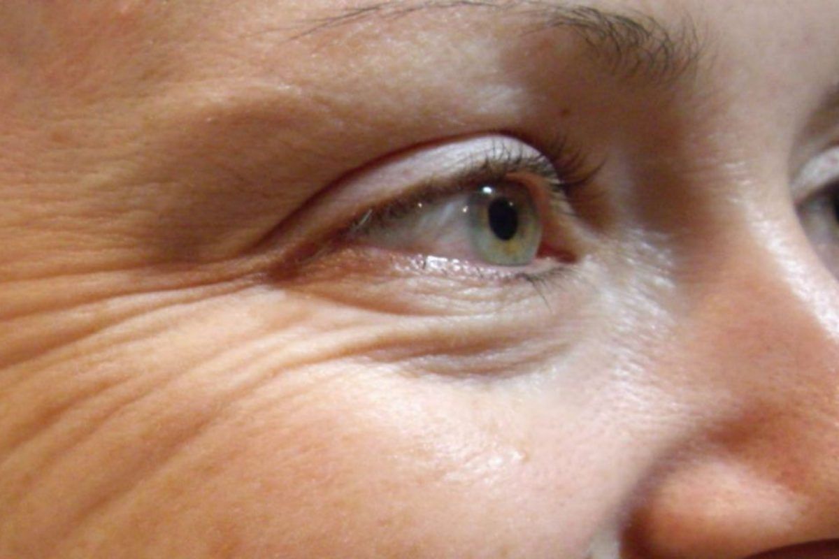 Το μηλόξυδο είναι το απόλυτο φυσικό συστατικό που εξαφανίζει τις ρυτίδες: Μάθε να το χρησιμοποιείς σωστά και κάνε το δέρμα σου να λάμπει