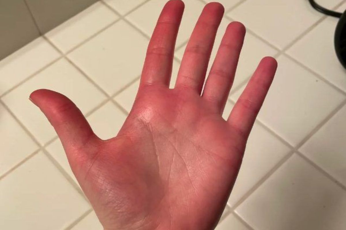 10 σημάδια που δείχνουν πως έχεις ανεβασμένο σάκχαρο