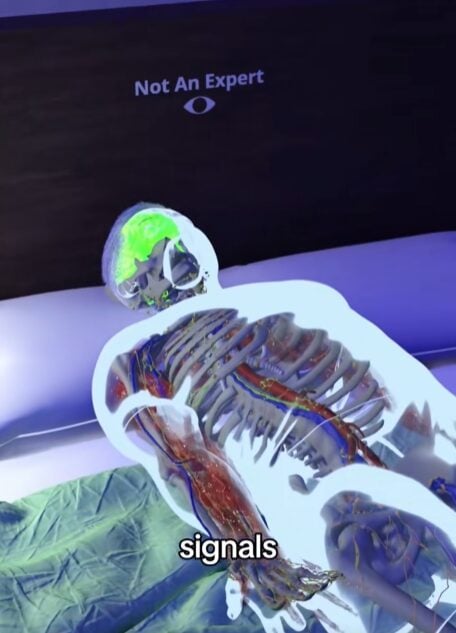 Υπνική παράλυση-προσομοίωση- Υπνική παράλυση-προσομοίωση-