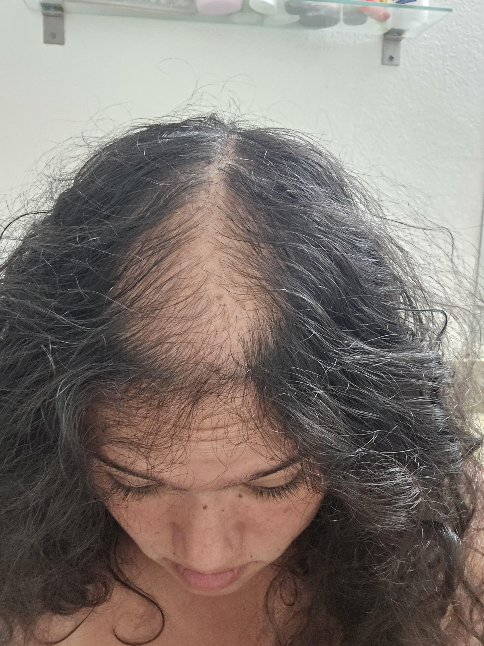 Έλλειψη σιδήρου: Όλες οι τροφές που είναι πλούσιες σε σίδηρο για να το αναπληρώσετε φυσικά