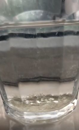 Πονόδοντος: Γιατροσόφια για να ανακουφιστείς γρήγορα από τον πόνο προτού πας στο γιατρό