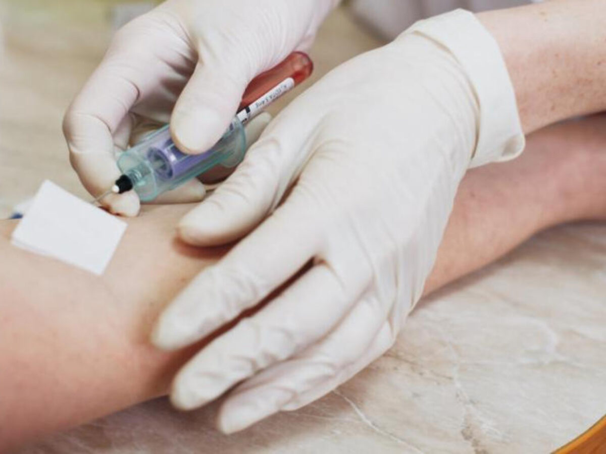 Πρόγραμμα «Προλαμβάνω»: Ποιοι δικαιούνται δωρεάν εξετάσεις για τα νεφρά - Που κλείνετε το ραντεβού σας