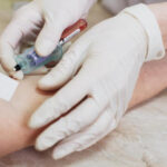 Πρόγραμμα «Προλαμβάνω»: Ποιοι δικαιούνται δωρεάν εξετάσεις για τα νεφρά - Που κλείνετε το ραντεβού σας