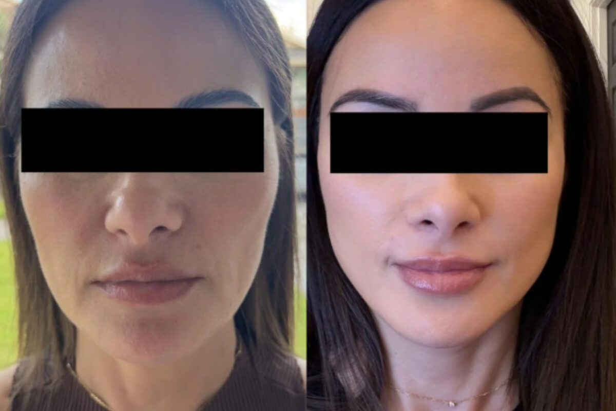 Το μυστικό των supermodels για άμεσο lifting αφτιαχτο