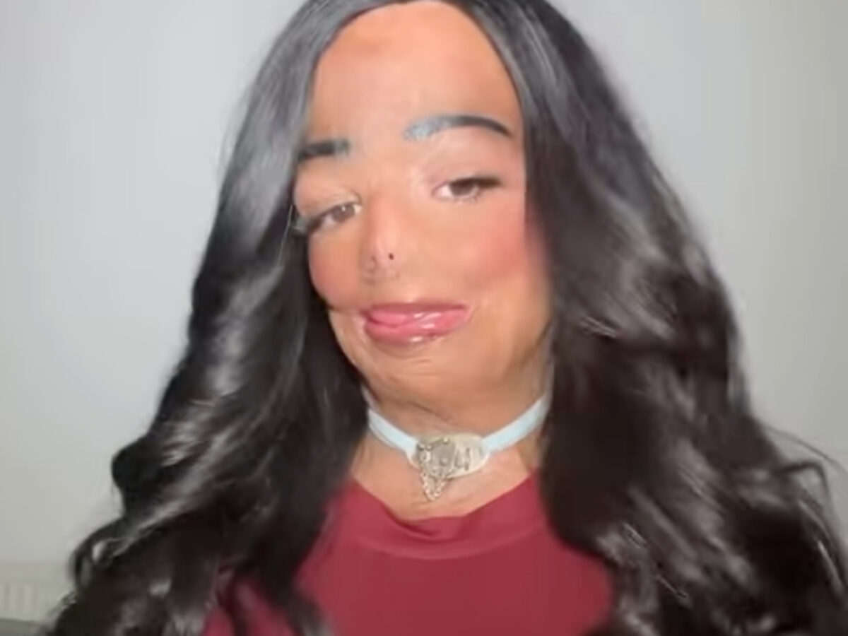 Τρόμος με 12χρονη που τυλίχτηκε στις φλόγες από σαμπουάν για ψείρες