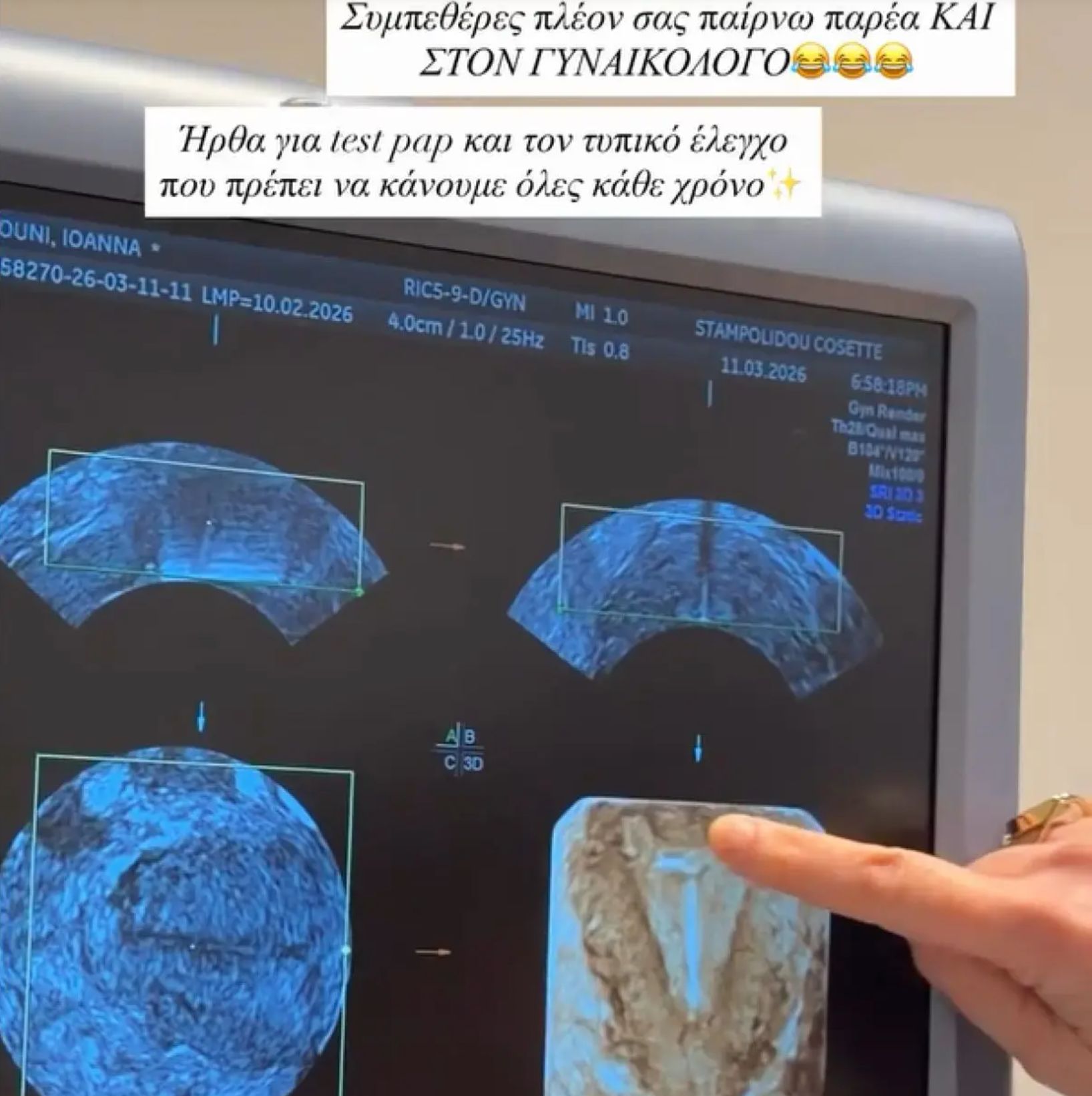 Είναι έγκυος η Ιωάννα Τούνη; Ο υπέρηχος που φούντωσε τις φήμες