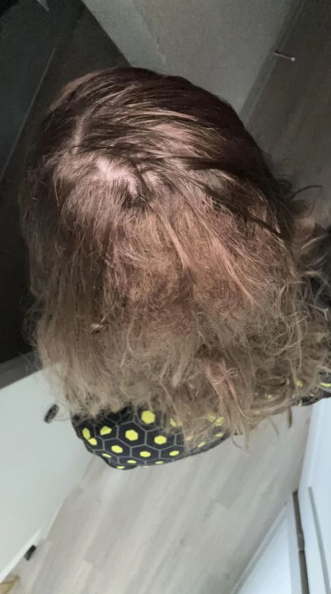 Γιατί τα μαλλιά μου γίνονται με το παραμικρό κόμπος και δε ξεμπερδεύονται εύκολα; Όλα τα κόλπα να το διορθώσεις