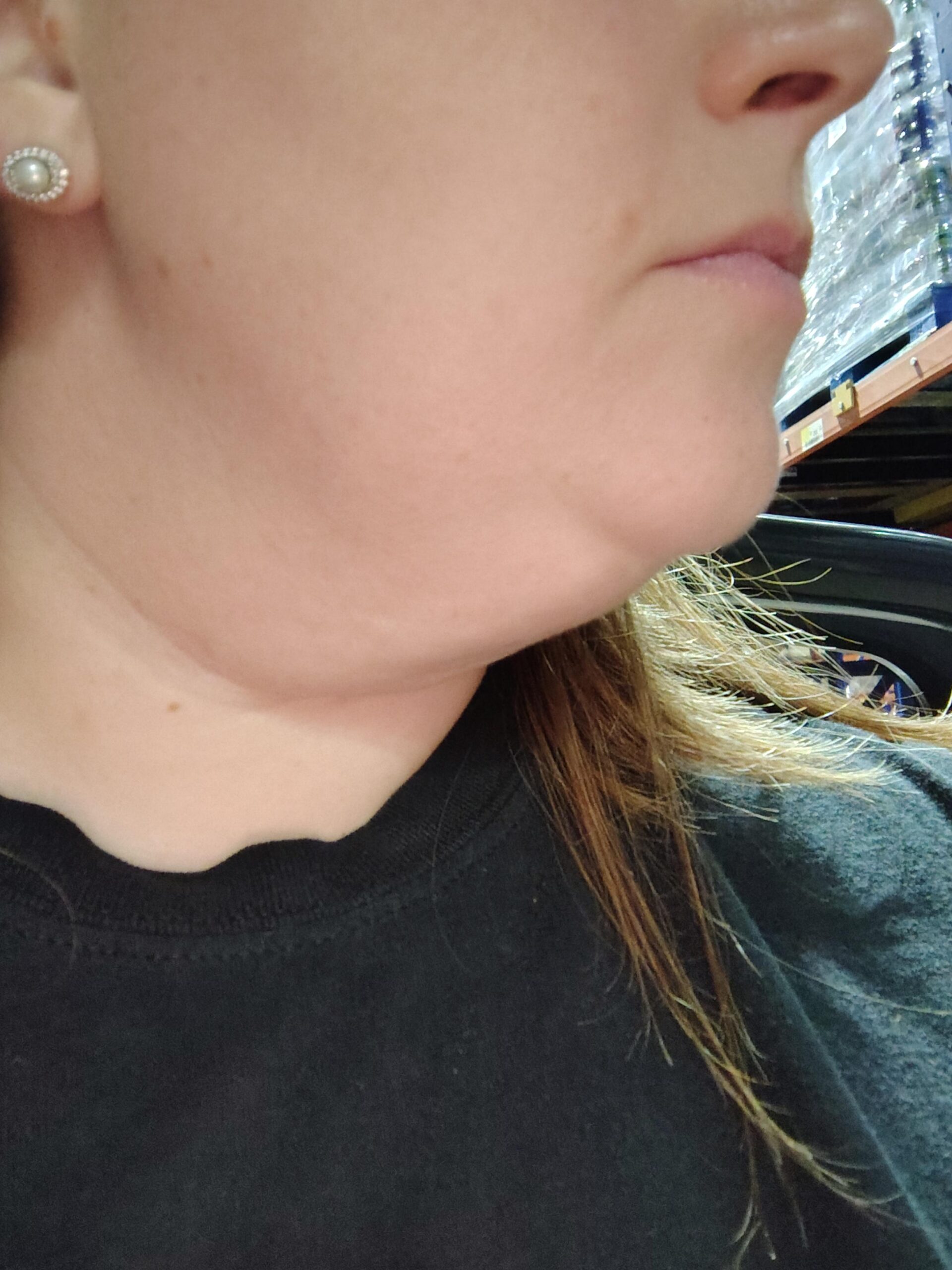 Η καλύτερη μάσκα προσώπου που συσφίγγει το προγούλι και τη χρησιμοποιώ καθημερινά