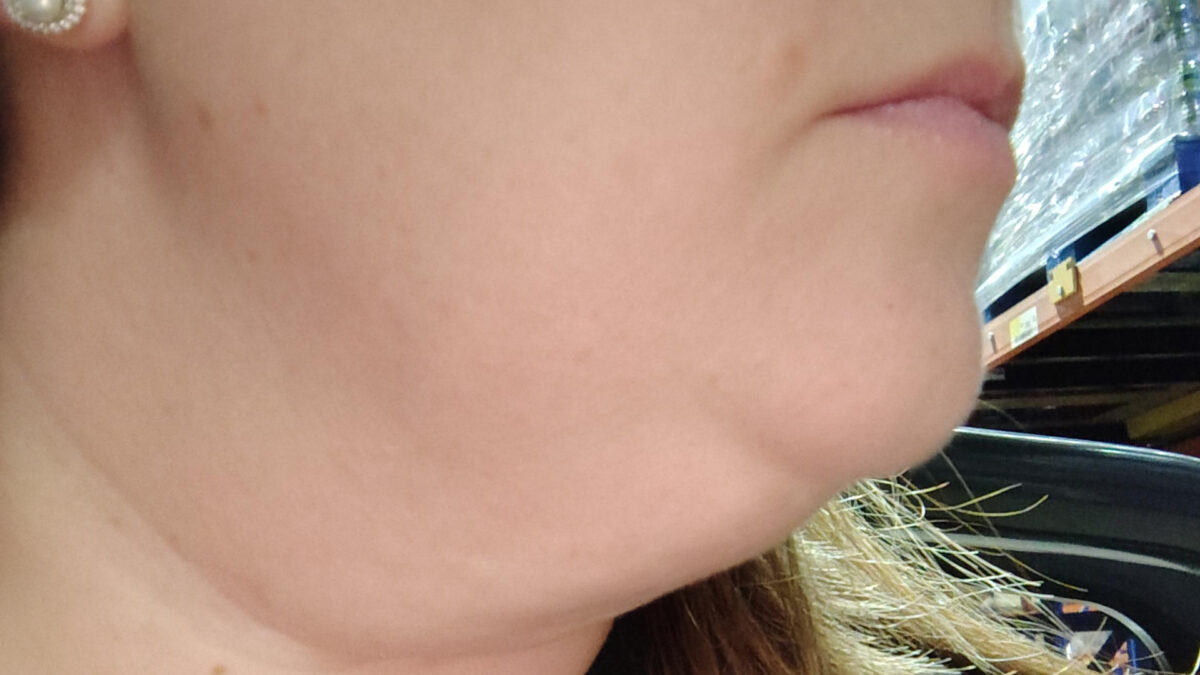 Η καλύτερη μάσκα προσώπου που συσφίγγει το προγούλι και τη χρησιμοποιώ καθημερινά