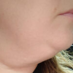 Η καλύτερη μάσκα προσώπου που συσφίγγει το προγούλι και τη χρησιμοποιώ καθημερινά