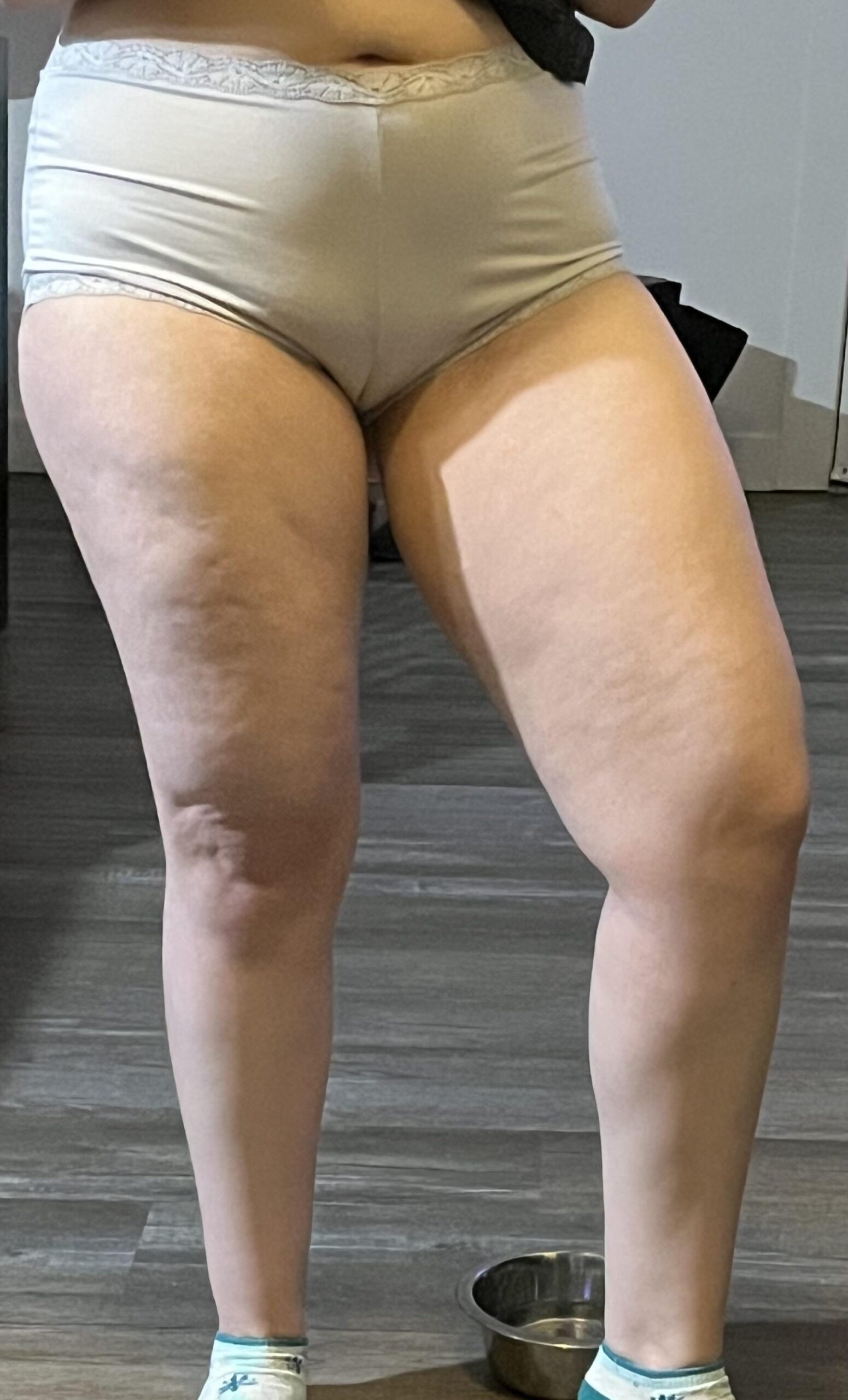 Κυτταρίτιδα ή λιποίδημα ; Δες τις διαφορές