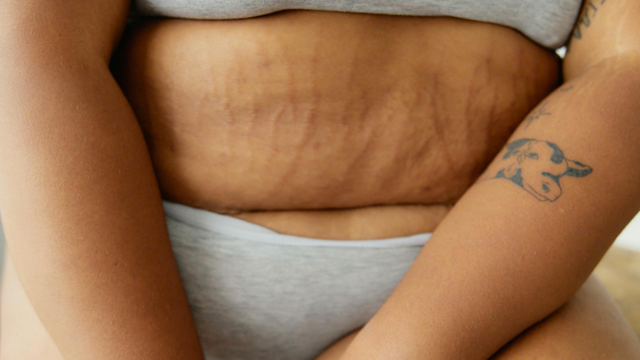 Οι καλύτεροι υδατάνθρακες που αν τους βάλεις στη διατροφή σου θα χάσεις σπλαχνικό λίπος