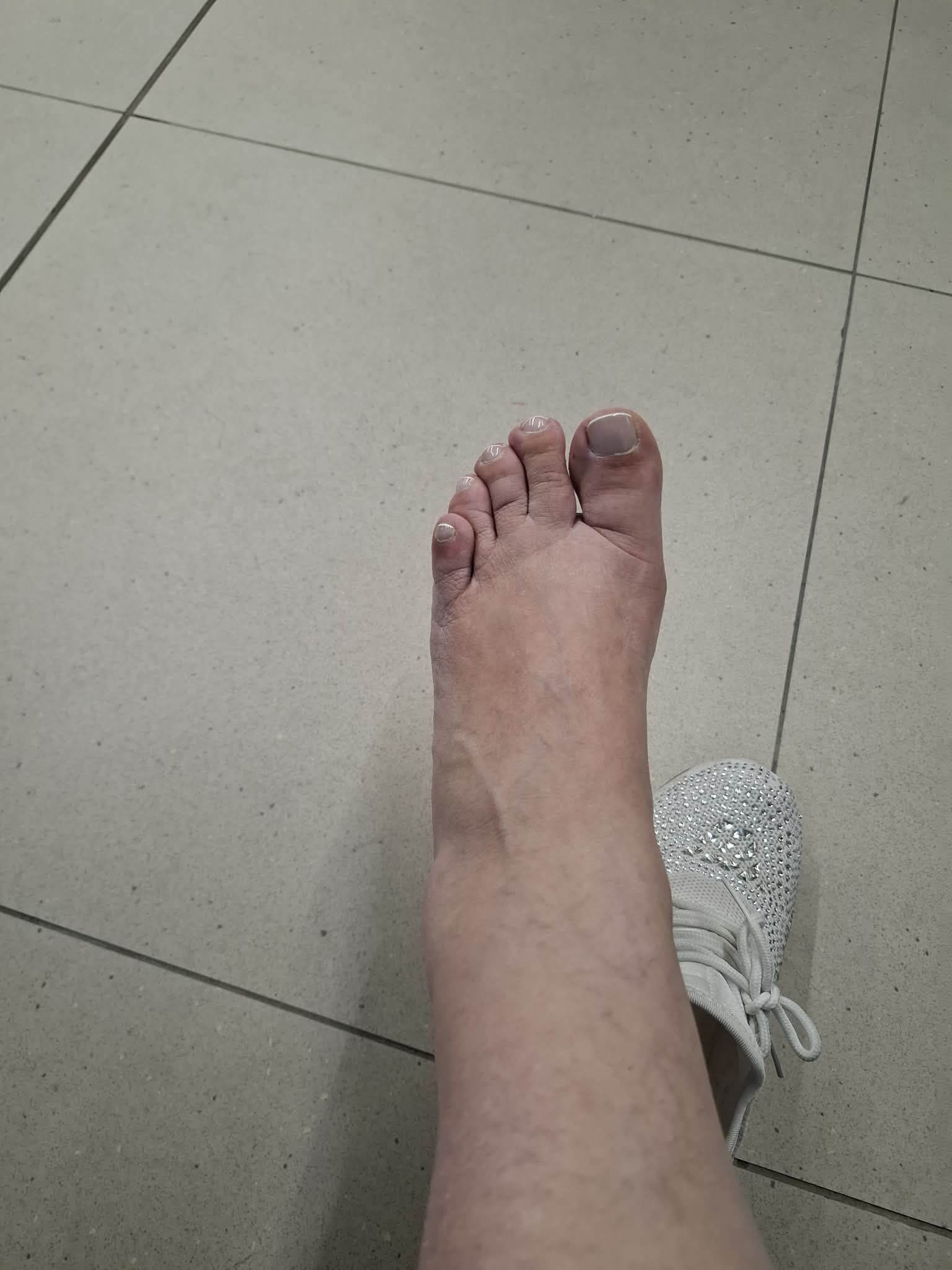 Σοβαρό ατύχημα για τη Βάσια Παναγοπούλου- Φωτογραφίες